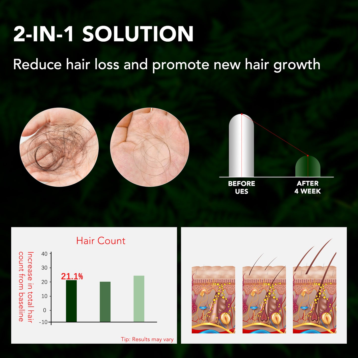 Minoxidil 5% Topical Solution Spray Treatment